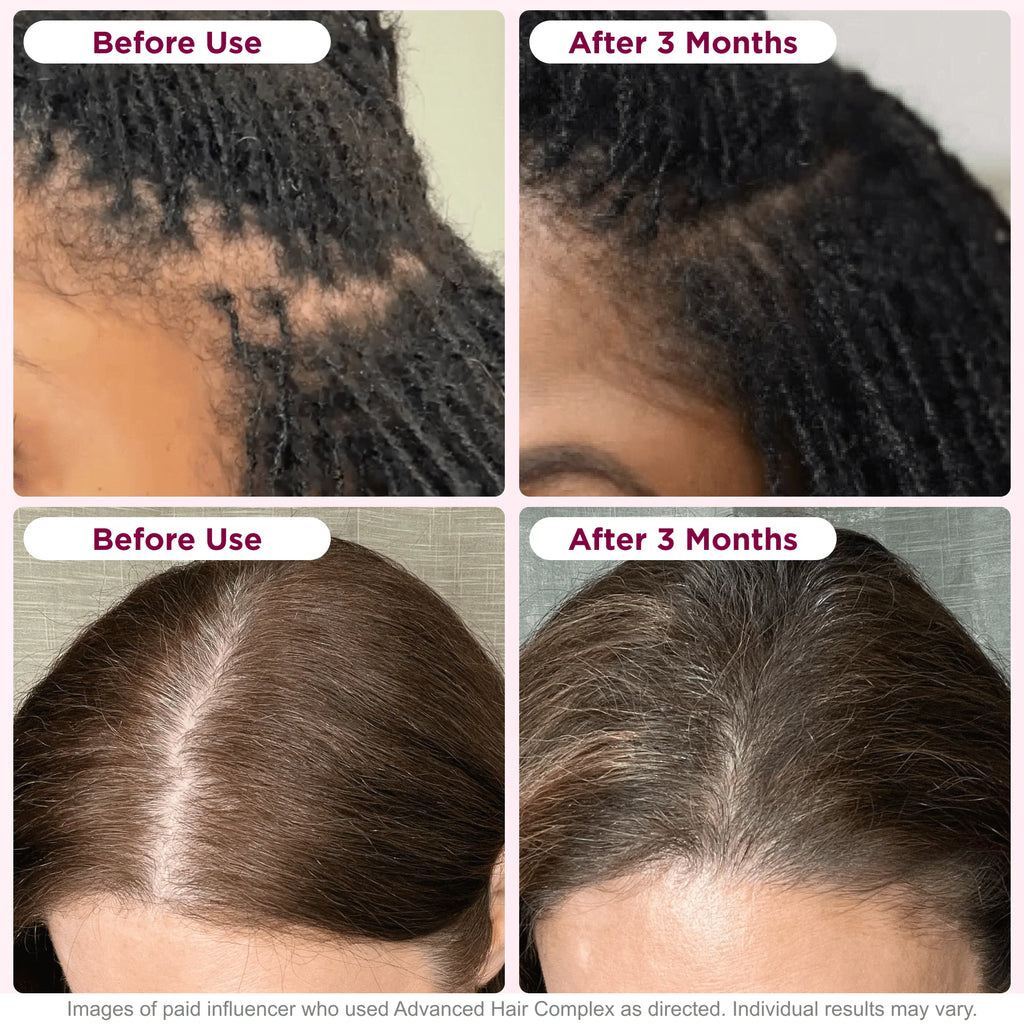30 Capsules Hair Growth Supplement with Biotin C14628