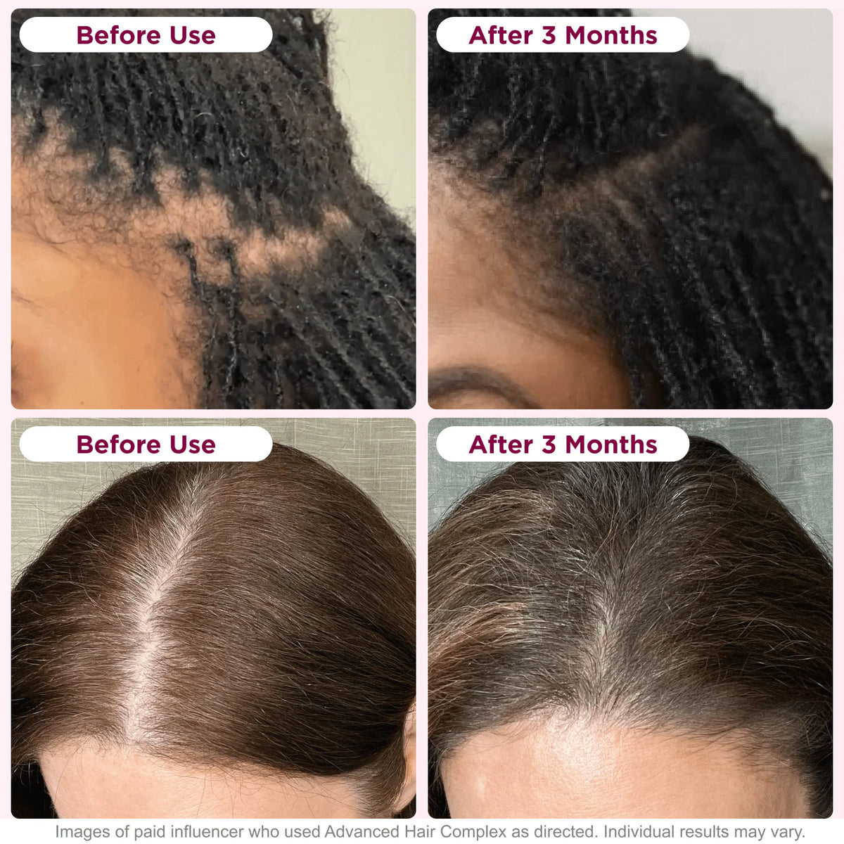 30 Capsules Hair Growth Supplement with Biotin C14628